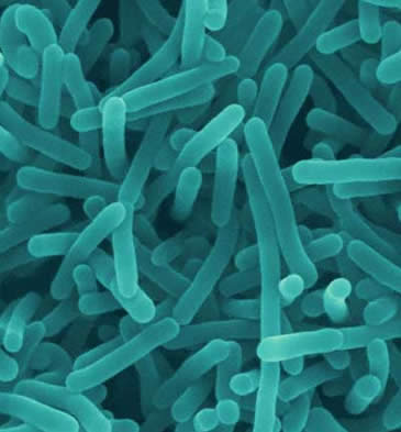 ¿Qué es la listeriosis y cómo podemos evitarla?